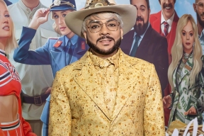 Киркоров продает квартиру с Пугачевой, чтобы вернуться на сцену после страшного ожога