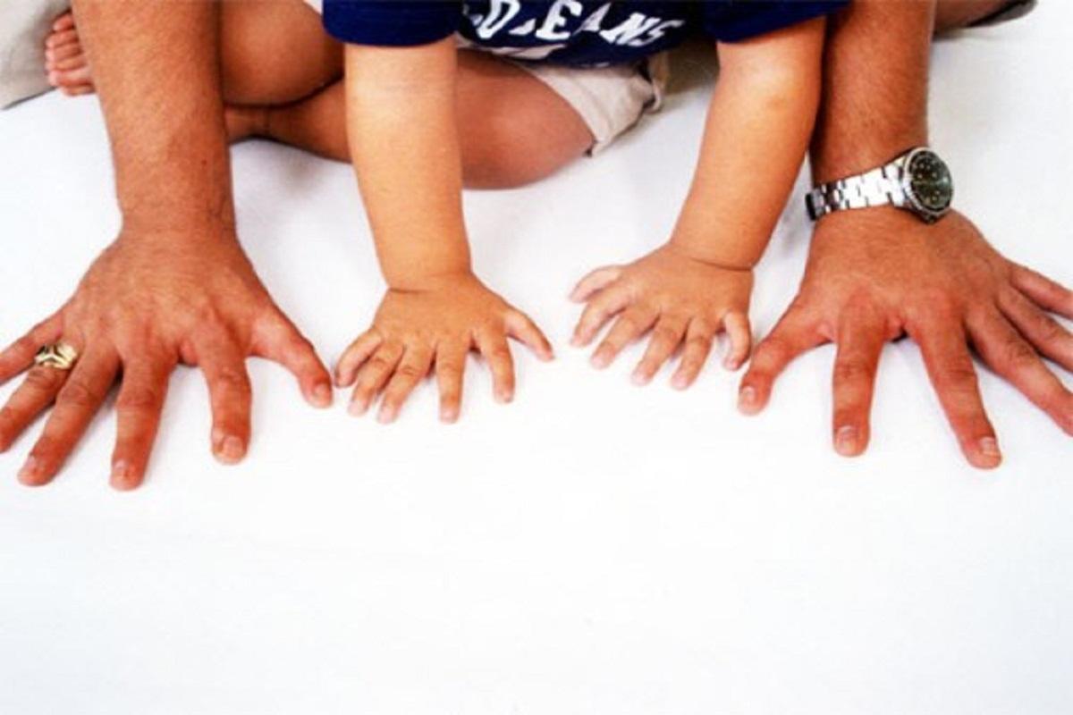 Ученые выявили мутацию, из-за которой у новорожденных появляются лишние пальцы