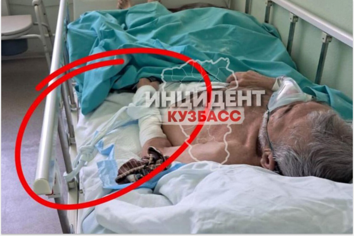 В Кемерове пациента жестоко привязывали к кровати и выписали обездвиженным