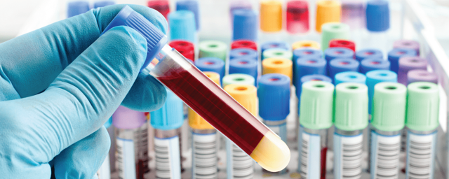 В США разработали тест крови, распознающий 50 видов рака