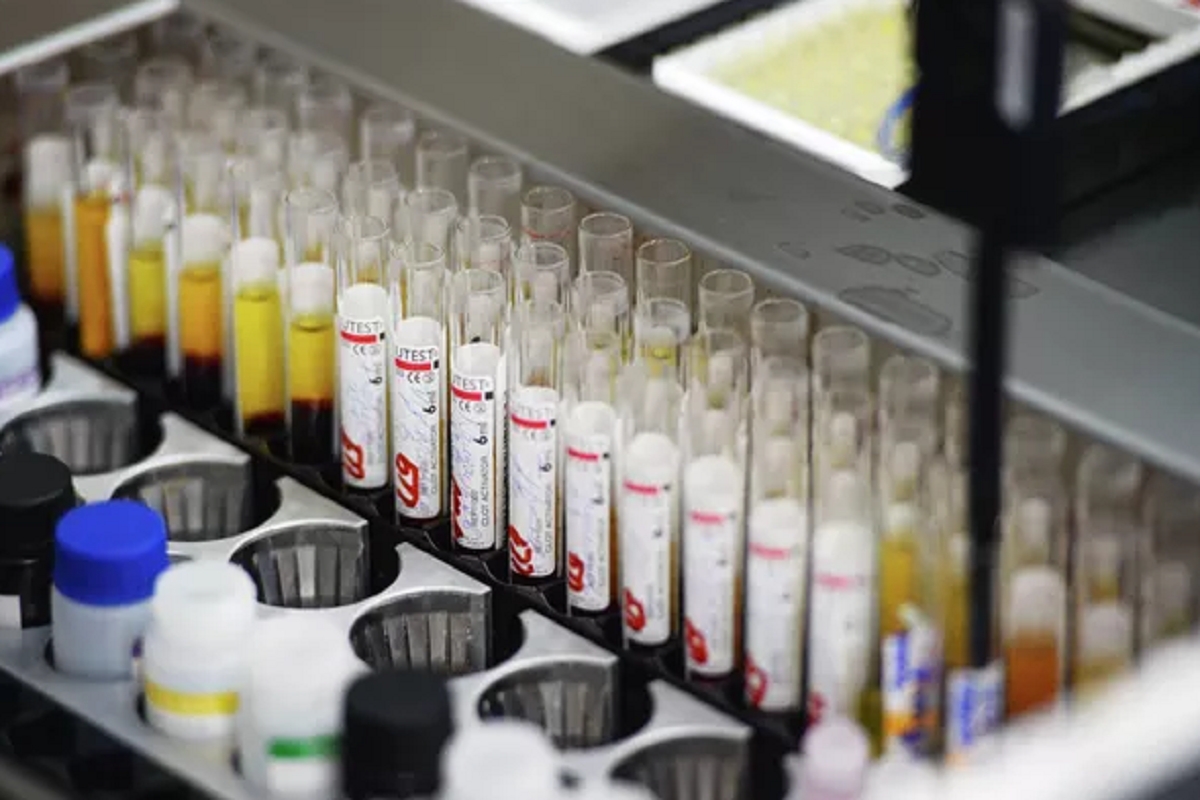 В Новосибирской области снизилась заболеваемость гепатитом