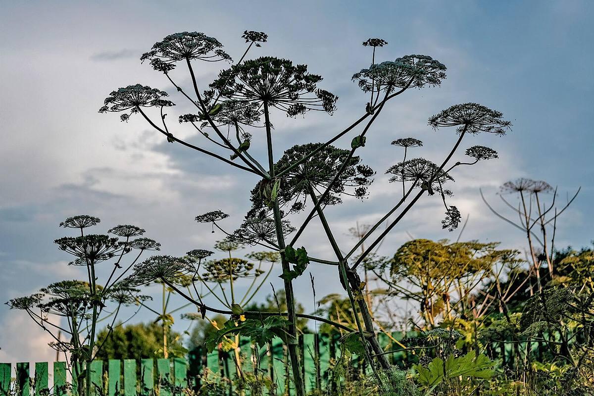 В Москве медики вылечили дачника с ожогами 80% поверхности тела