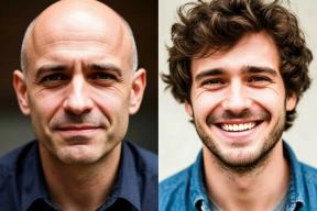 Больше никаких париков: Китайские учёные нашли средство от облысения. Почему подойдет не всем?