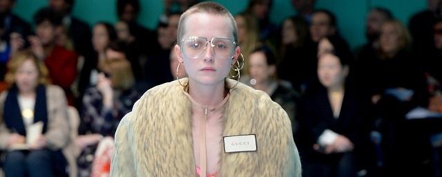 Нижегородская модель стала лицом Gucci после трепанации черепа