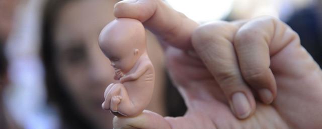 В ГД не поддержали законопроект о выведении абортов из системы ОМС