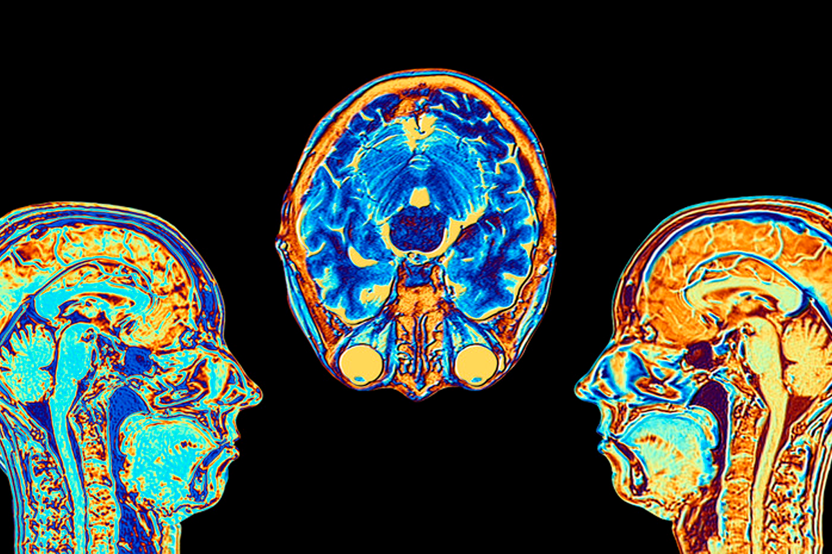 Российские учёные разработали специальную карту мозга
