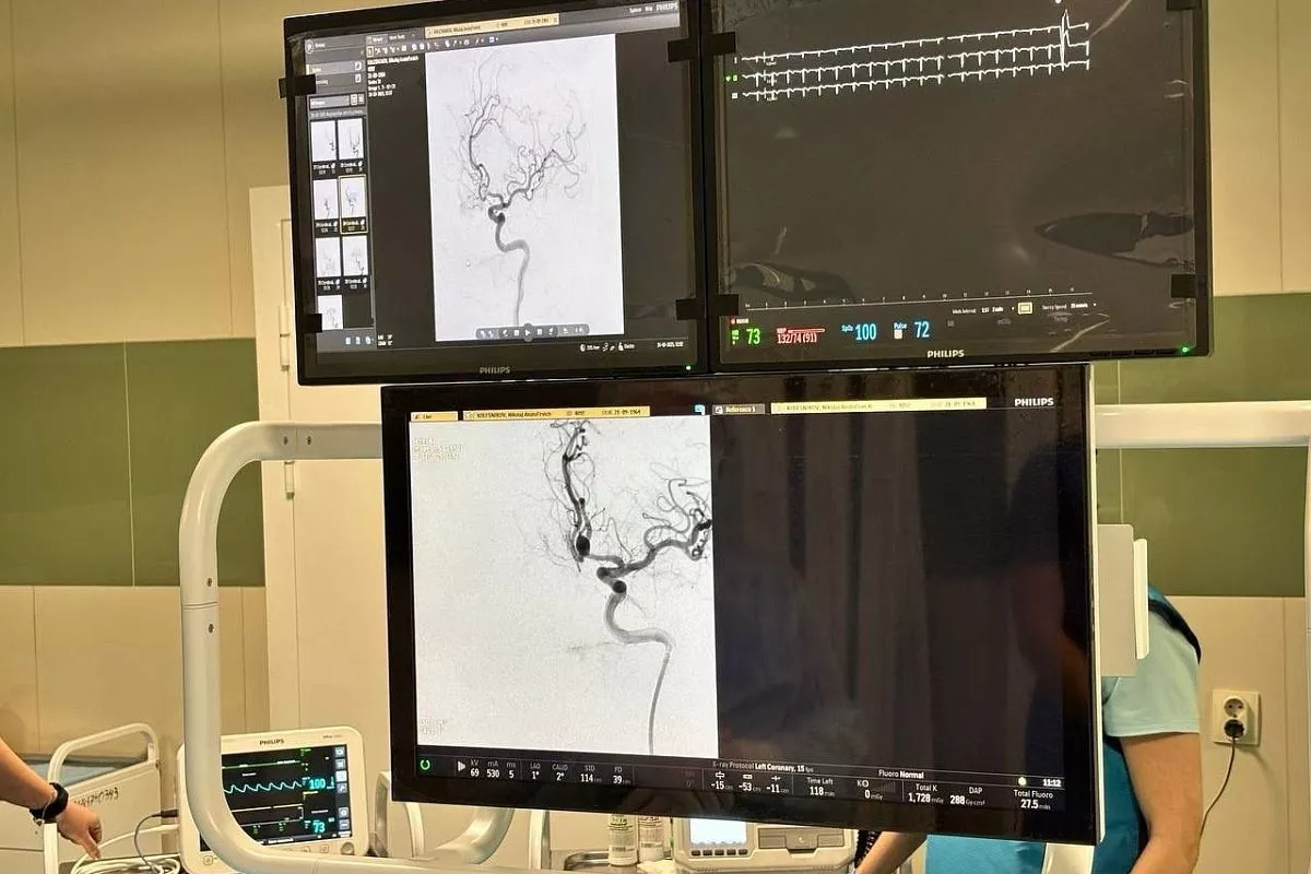 Лабинская ЦРБ успешно выполнила эмболизацию аневризмы головного мозга