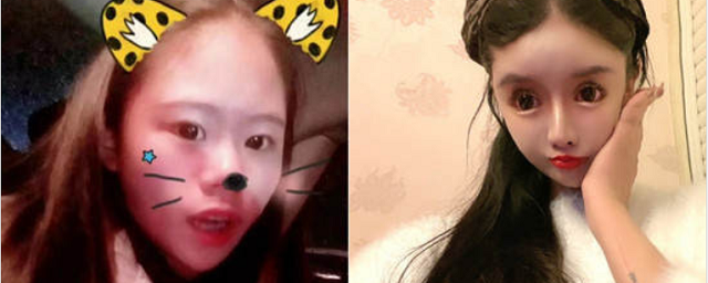Китайская школьница за 3 года сделала 100 пластических операций