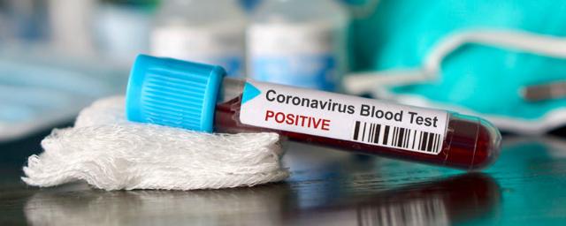 Еще 87 человек в Крыму заболели коронавирусом
