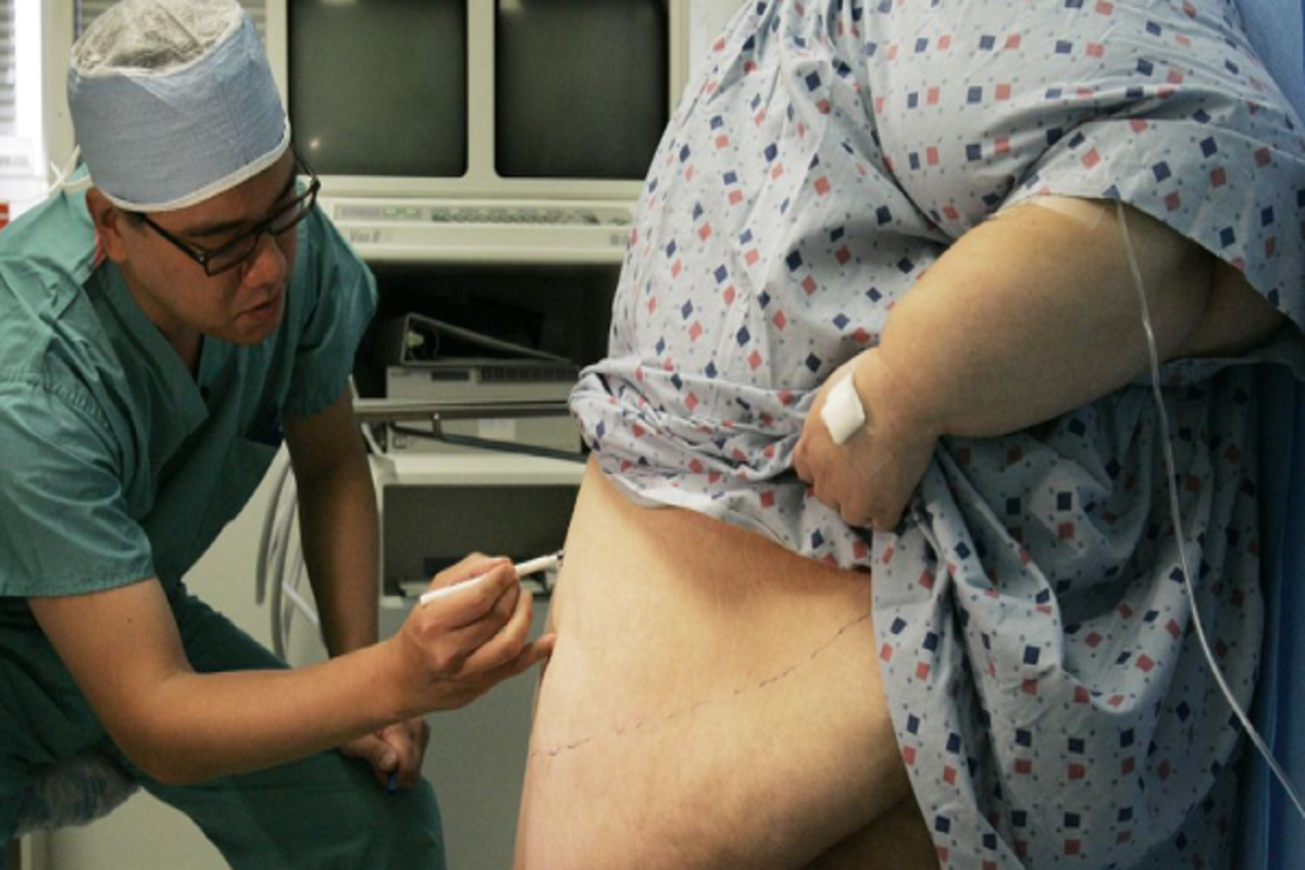 Мурашко: Россияне, отказавшиеся от правильного питания, перегружают систему здравоохранения