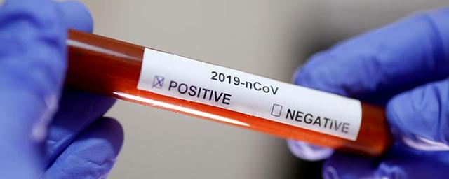 В Тамбовской области за сутки коронавирус подтвердили еще у 83 человек