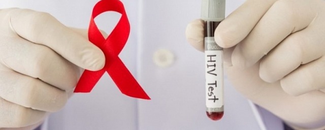 Новосибирцев зовут пройти бесплатный тест на ВИЧ