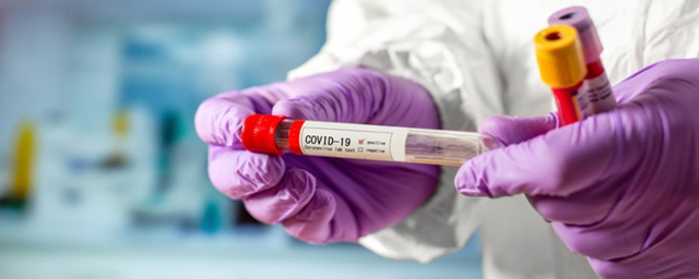 Адыгея вошла в топ-5 регионов по уровню обследования на коронавирус