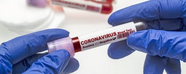 На Ставрополье еще 109 человек заболели коронавирусом