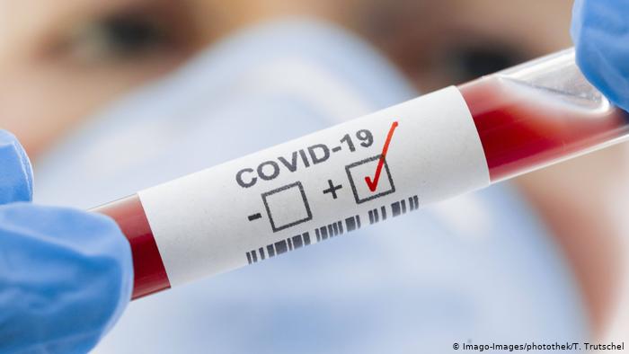 Еще девять новосибирцев с COVID-19 скончались от осложнений за минувший день