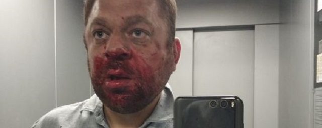 Оппозиционного журналиста и общественного активиста жестоко избили в Югре