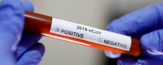 В Костромской области обнаружены еще 122 заразившихся коронавирусом