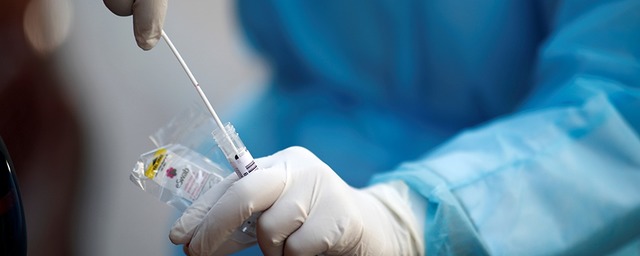 На Кубани за прошедшие сутки 125 человек заболели коронавирусом