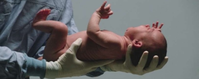 Самарские врачи провели сложную операцию младенцу с врожденной диафрагмальной грыжей