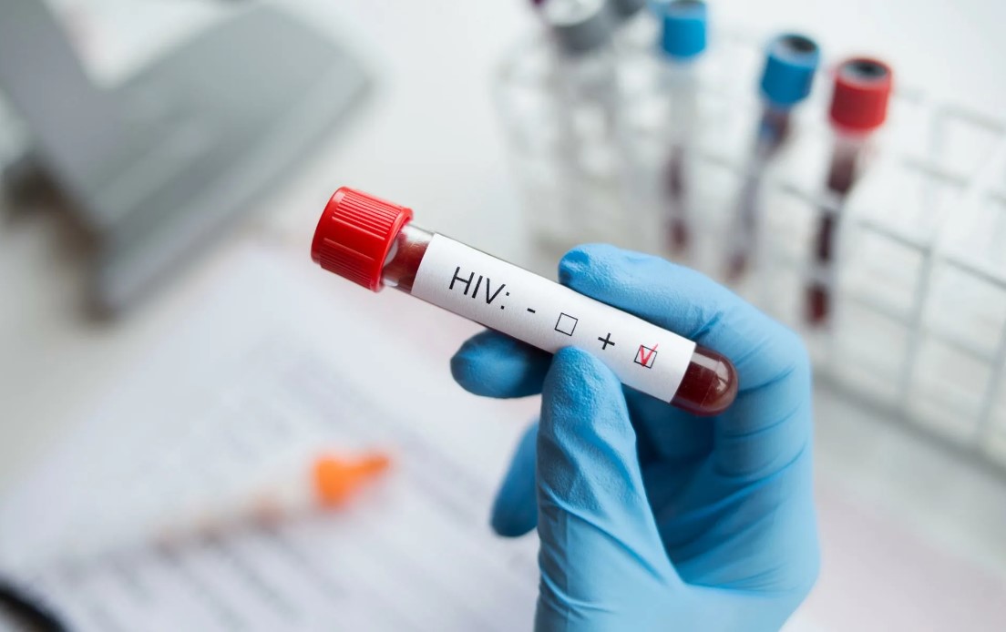 В Орловской области увеличилось количество ВИЧ-инфицированных жителей