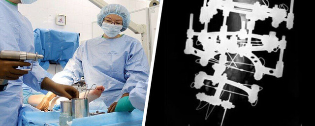 Курганские врачи предотвратили операцию по ампутации ноги у девочки