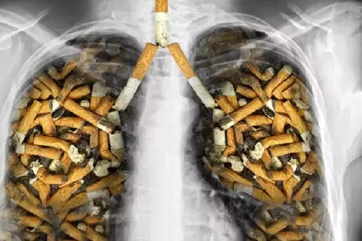 Онколог Сулиманов предупредил о вреде курения