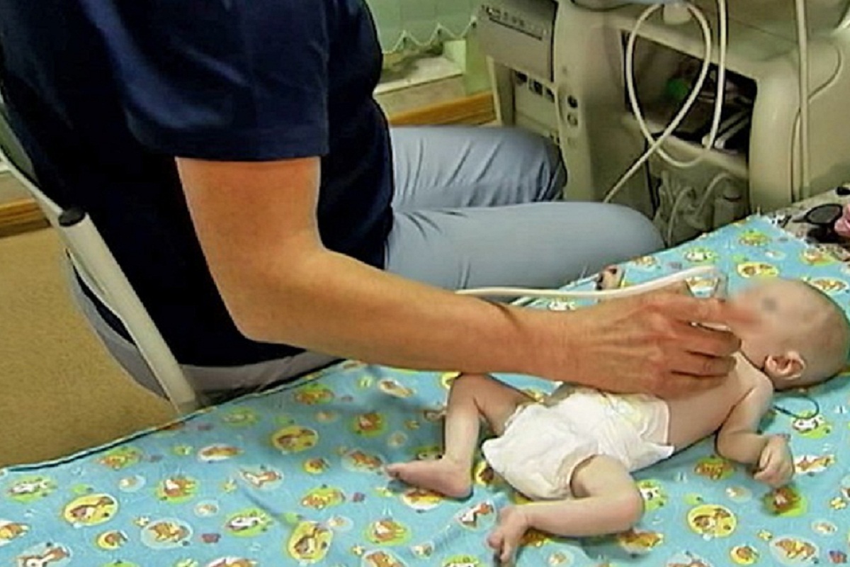 Кардиохирурги из Новосибирска провели уникальную операцию на сердце младенца