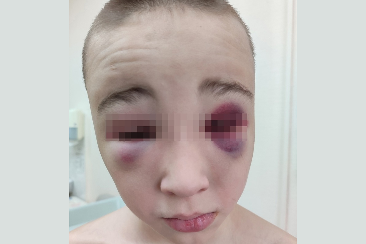 Тренер военного центра в Новосибирске рассказал, как мальчик получил травму во время сборов