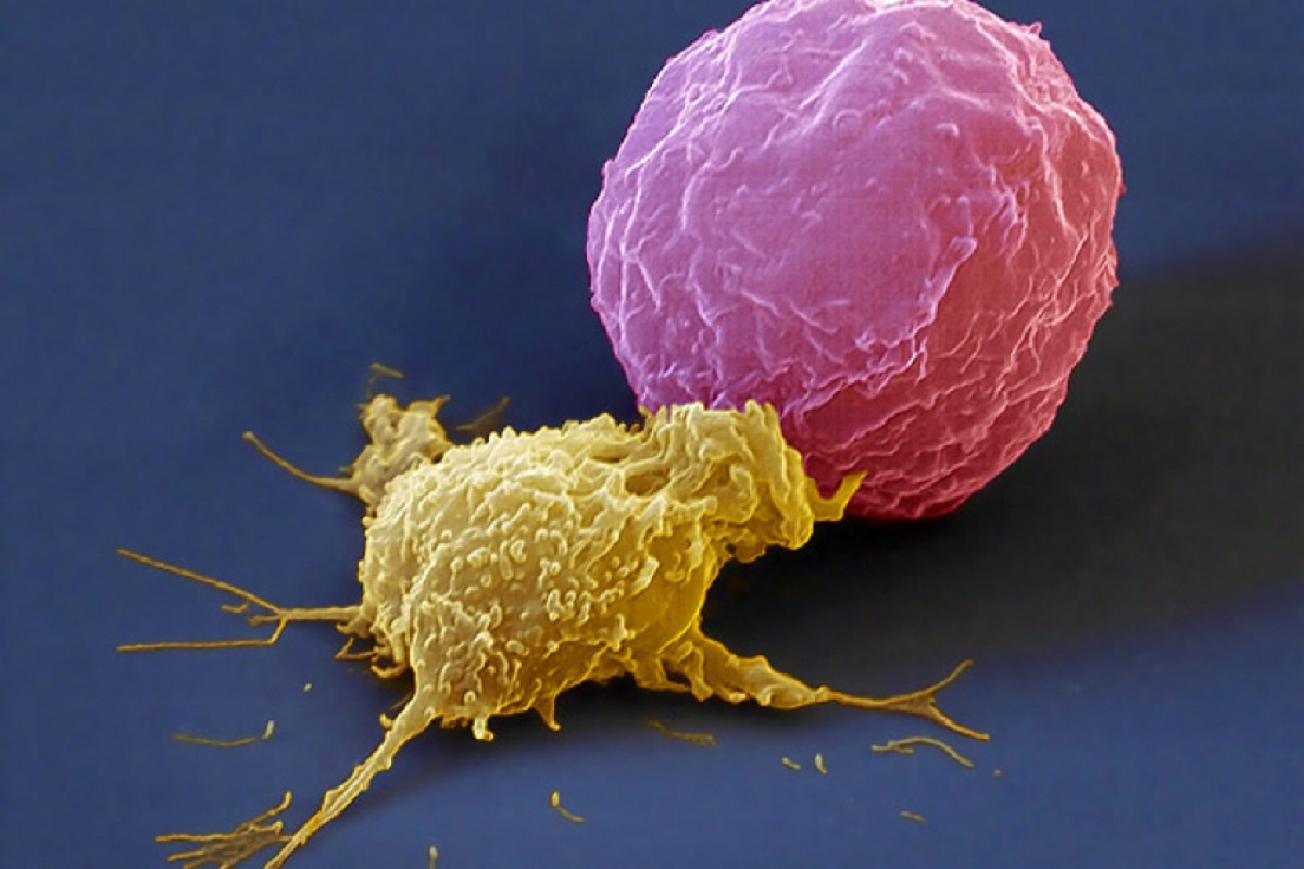 Перепрограммирование макрофагов лекарством JHU083 подавляет рак мочевого пузыря и простаты