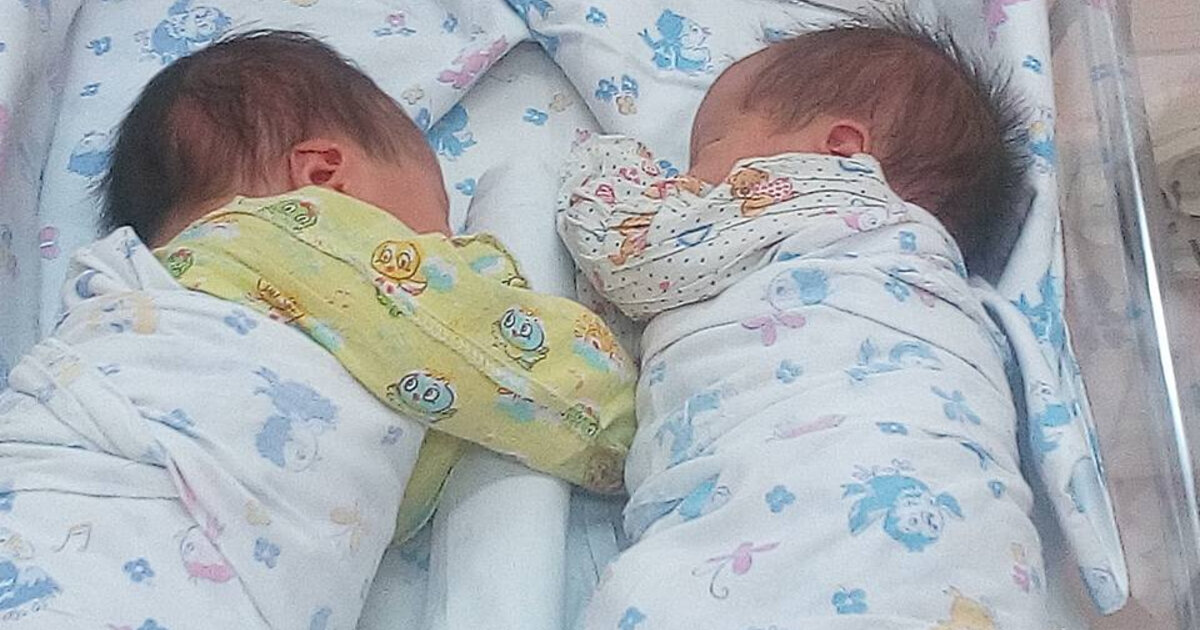 Жительница Рязани родила близнецов, находившихся в одном плодном пузыре и имевших одну плаценту