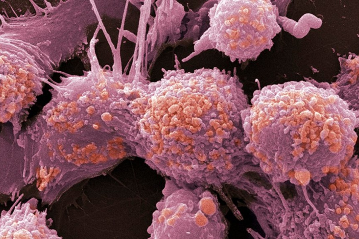 Томские ученые научились бороться с метастазами рака