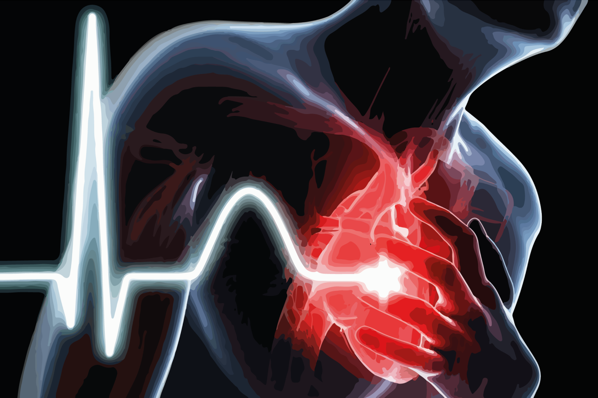 Ученые рассказали, как в домашних условиях оценить вероятность внезапной смерти от инфаркта