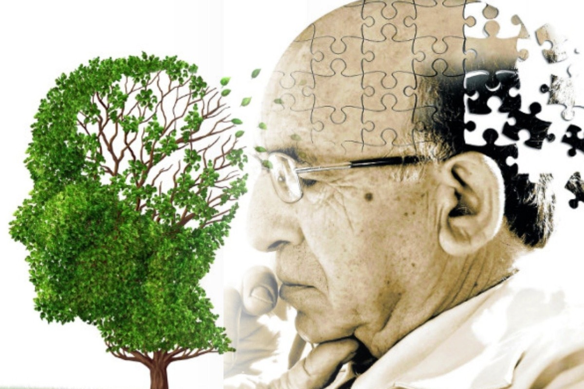 Найден новый способ заразиться болезнью Альцгеймера