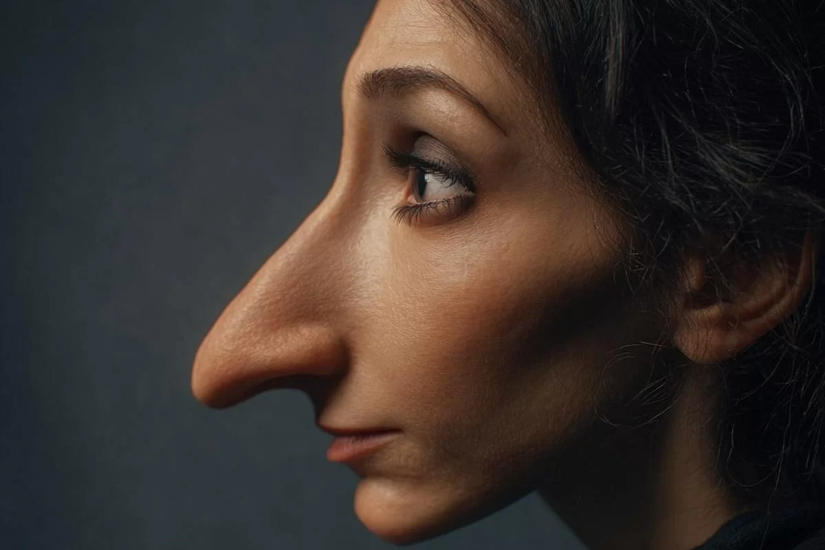 Точка перезапуска жизни: как ринопластика может помочь человеку стать увереннее?