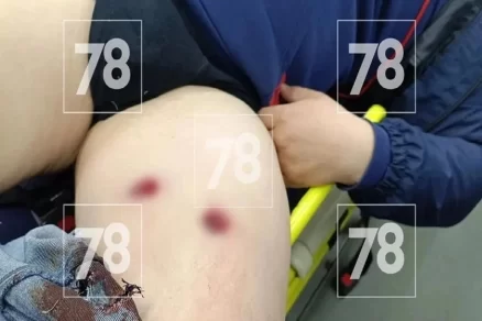 Мужчина оказался ранен полицейским после ссоры под Выборгом