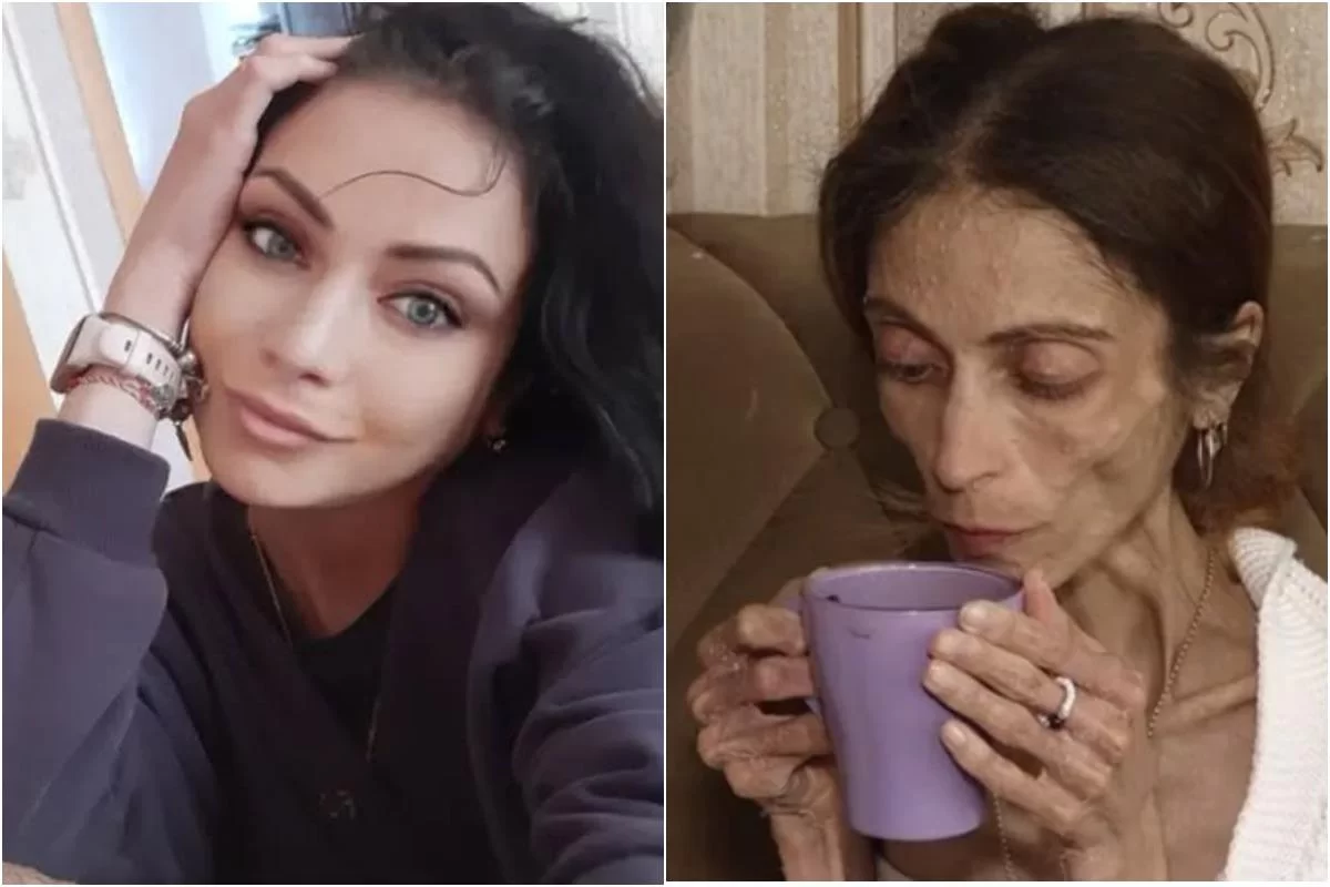 Организм поедал сам себя: как Яна Боброва с весом 20 кг смогла начать жизнь заново