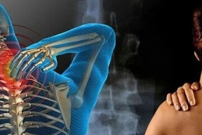 Невролог Юлия Березина рассказала, как определить причину болей в спине, пояснице и шее